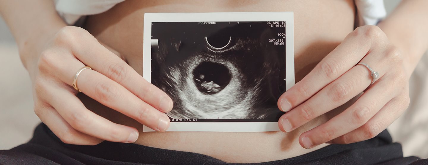 8 aranyos ötlet a várandósság bejelentéséhez 